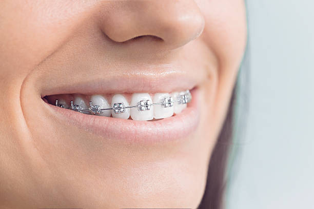 Best Tooth Extraction  in Roseburg Nth, OR